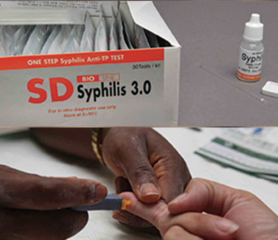 Hausse importante des infections sexuellement transmissibles dans plusieurs régions du monde